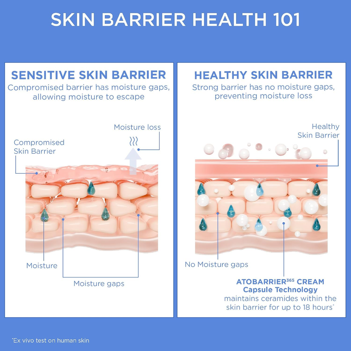 An educational infographic titled 'SKIN BARRIER HEALTH 101' comparing 'SENSITIVE SKIN BARRIER' and 'HEALTHY SKIN BARRIER' with labeled cross-section diagrams of skin layers, moisture gaps, and ceramide droplets. The left panel shows a compromised barrier with moisture loss, while the right panel depicts a healthy barrier with no moisture gaps.