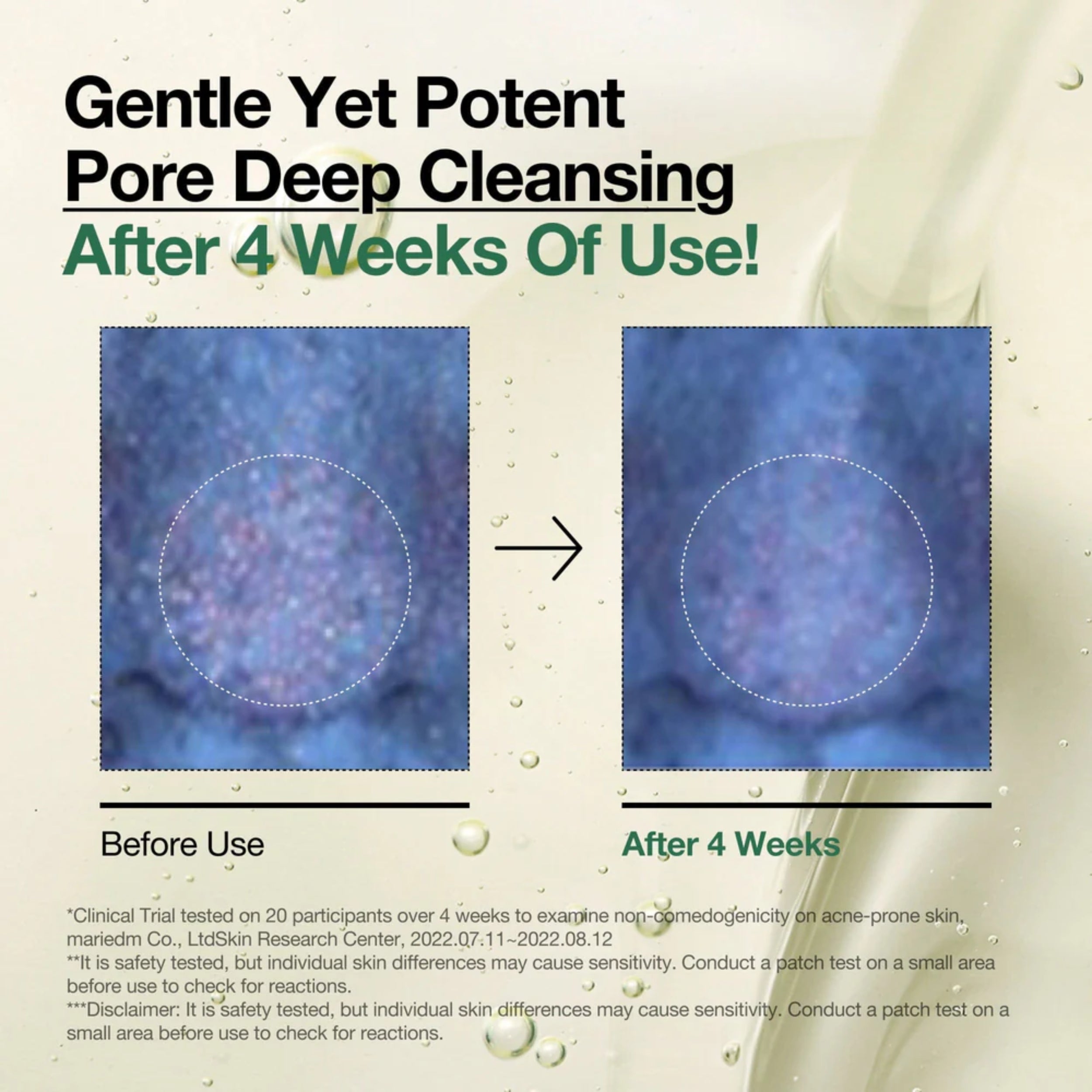 Advertisement for pore deep cleansing product showing before and after effects on skin texture.