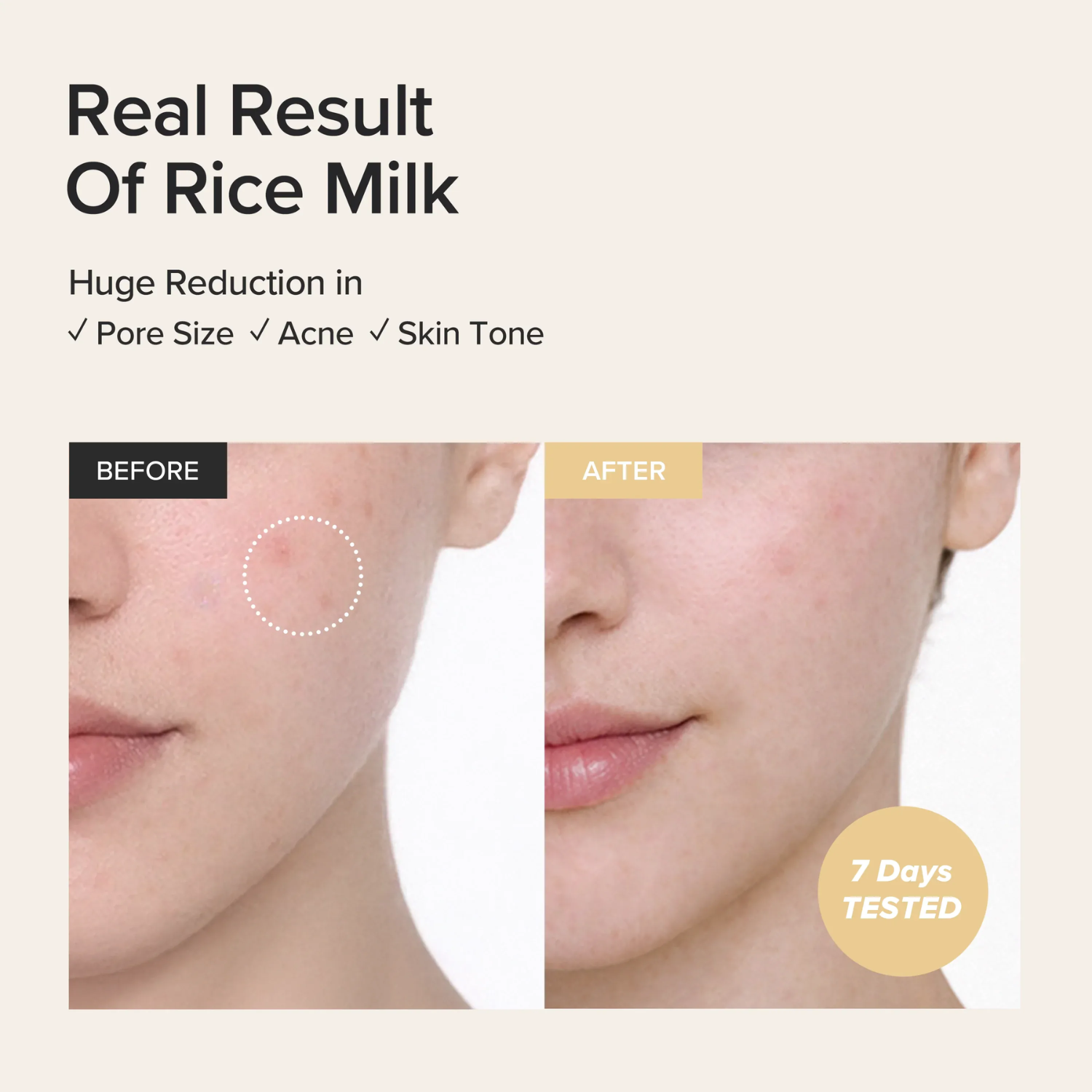 Before and after comparison of rice milk's effect on skin with text indicating pore size, acne, and skin tone improvements.