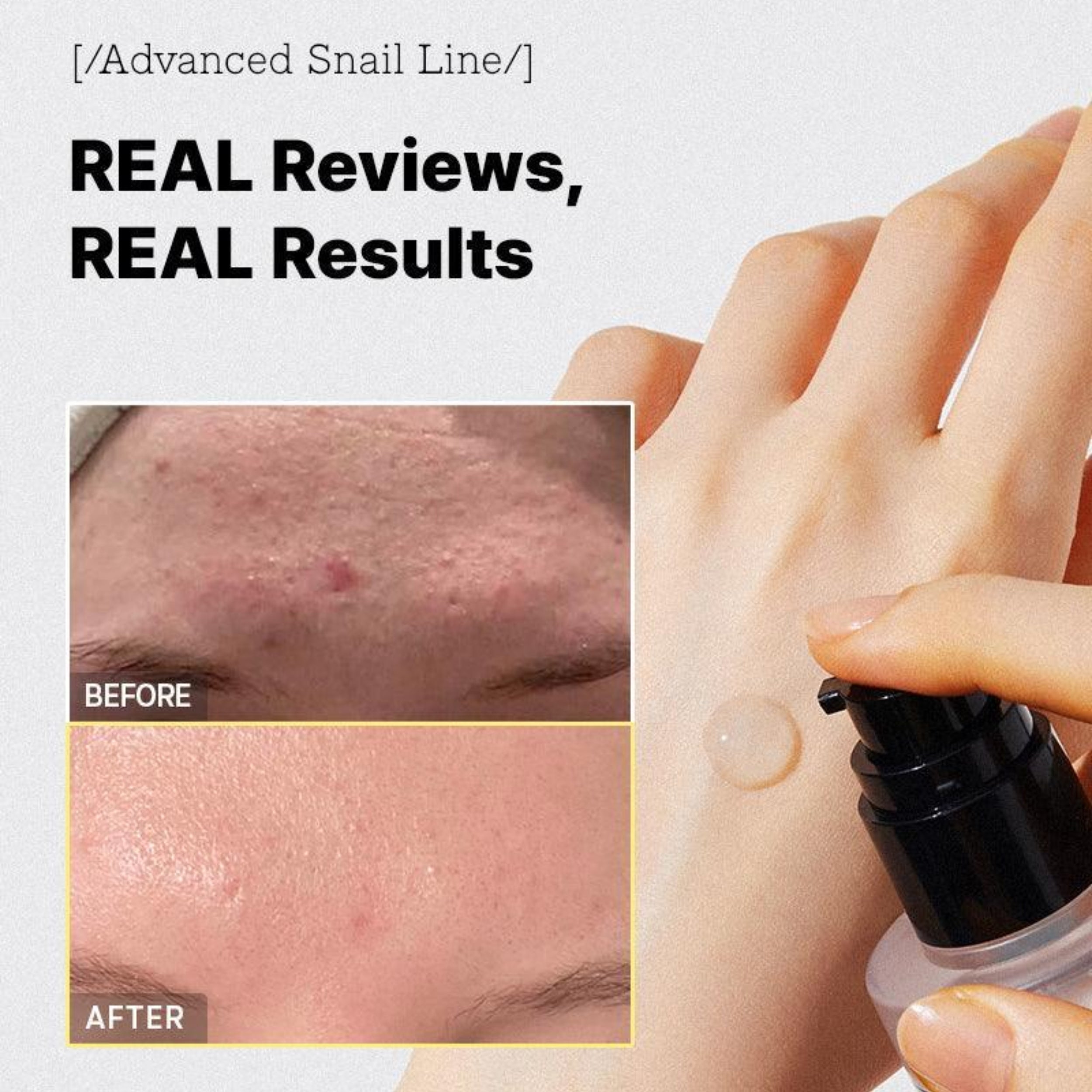 Product before and after use on skin with text 'Real Reviews, Real Results' and 'Advanced Snail Line'.
