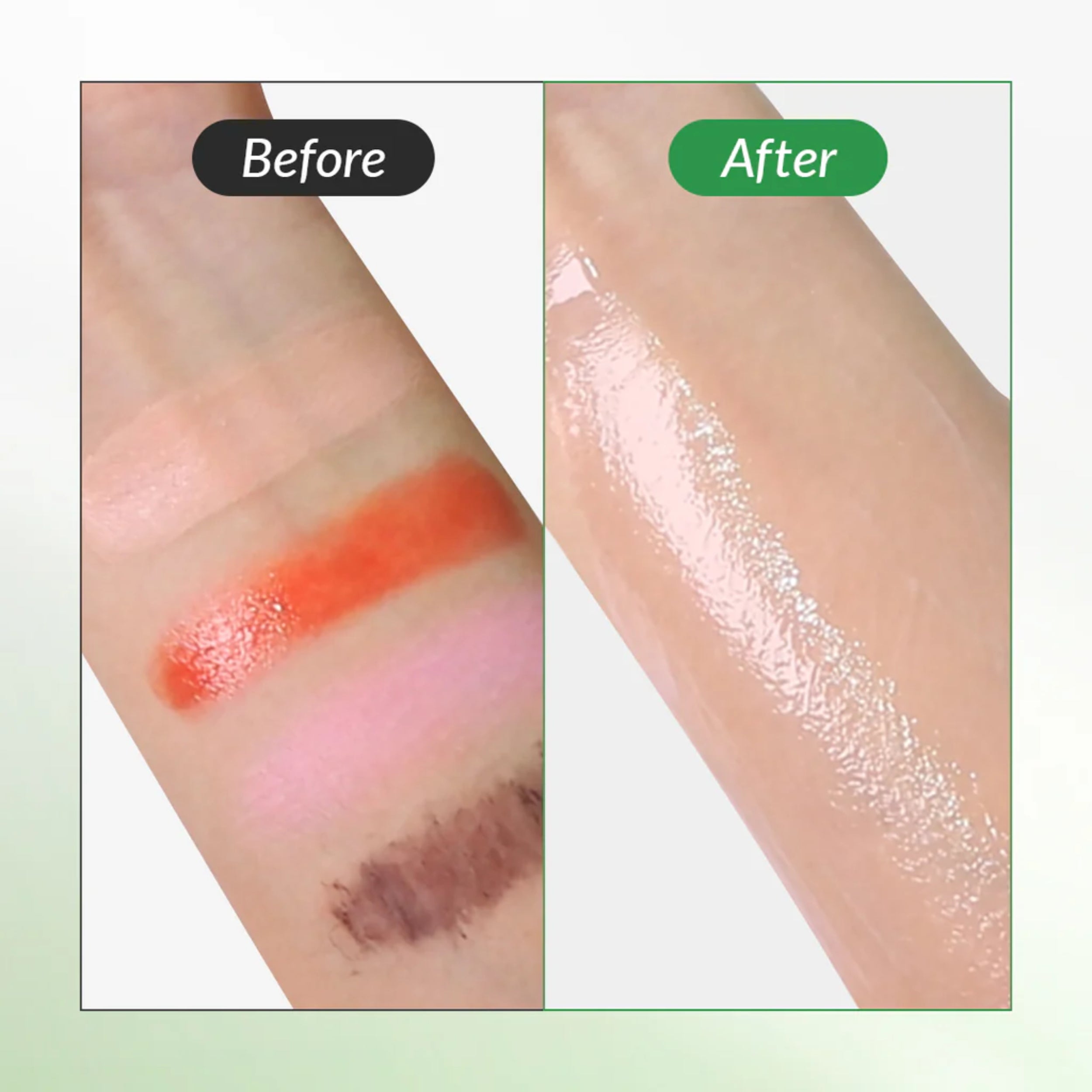 Before and after comparison of skin treatment on a person's arm.