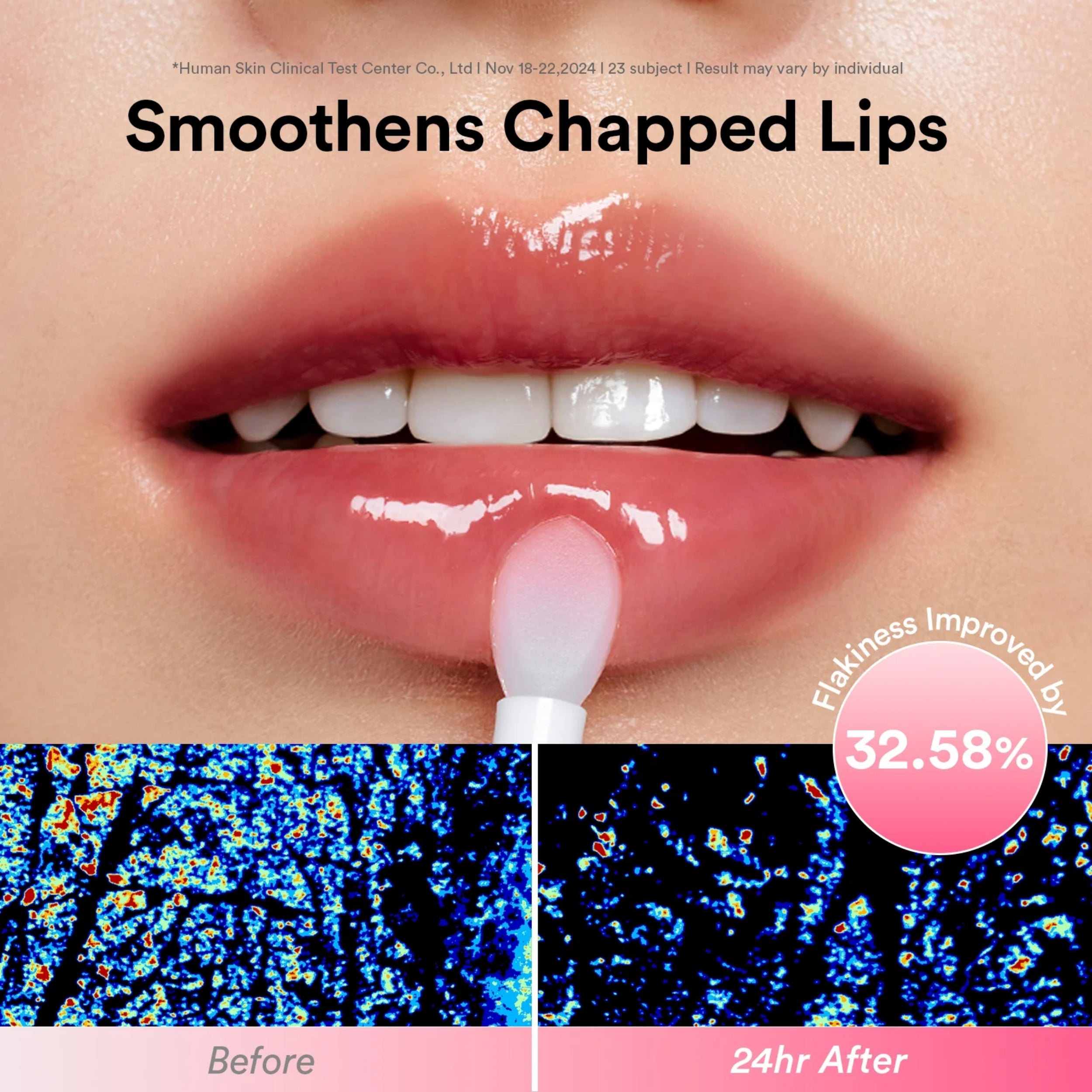 Lip balm with a before and after effect on lips, showing flakiness improvement.