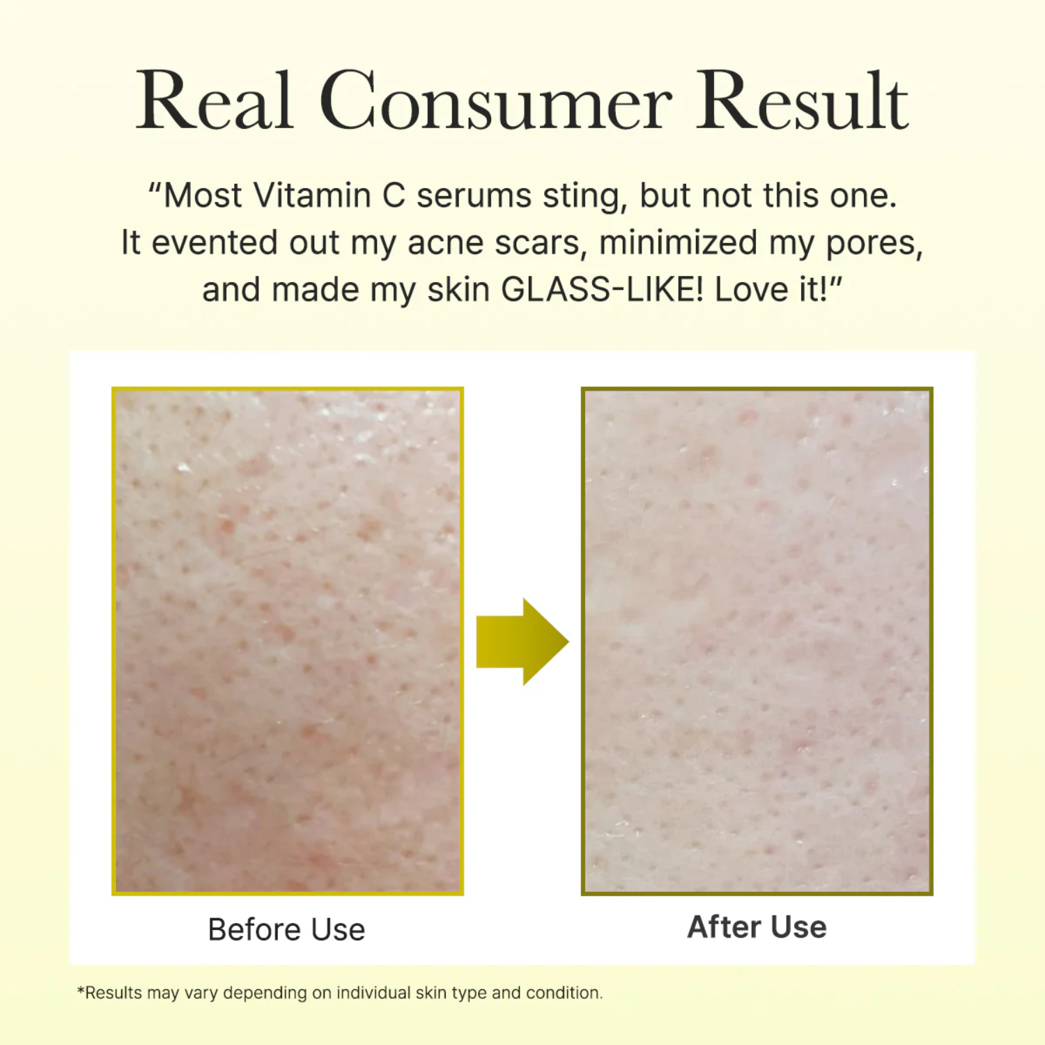 Before and After uses of Arencia Vitamin C booster shot with real results pictures